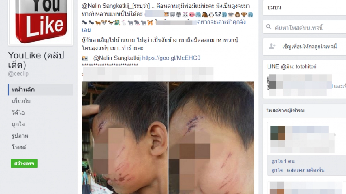 แจ้งตร.เลย! ลุงเมาทำร้ายหลานชายตัวน้อย แจ้งตร.เลย! ลุงเมาทำร้ายหลานชายตัวน้อย