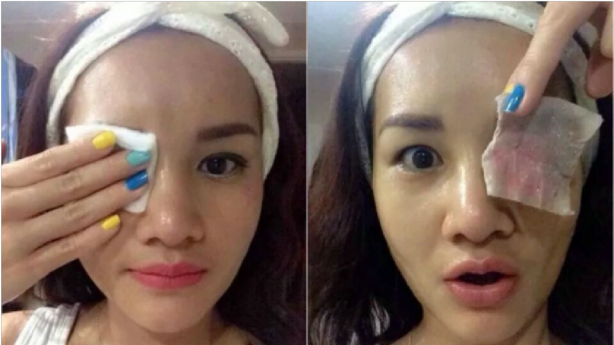  รีบล้างตา