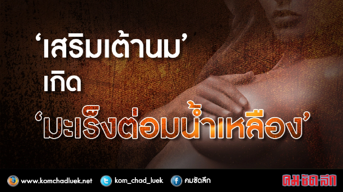 สหรัฐฯศึกษาพบ“เสริมเต้านม”เกิด“มะเร็งต่อมน้ำเหลือง”