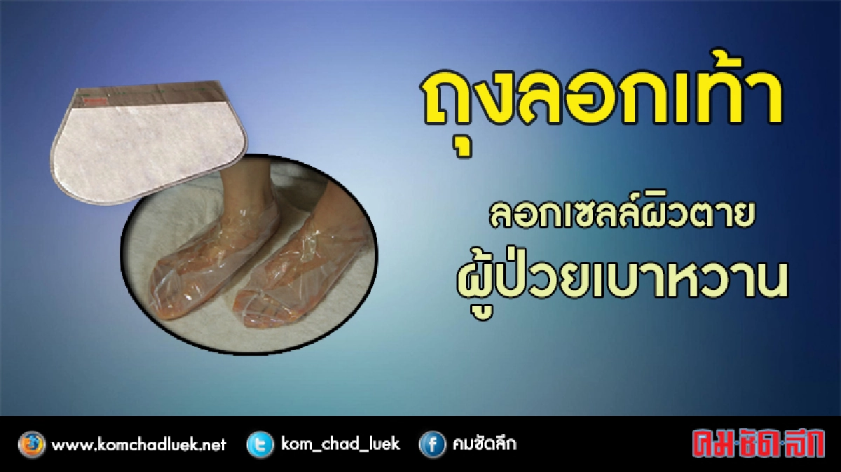 ถุงลอกเท้าผู้ป่วยเบาหวาน