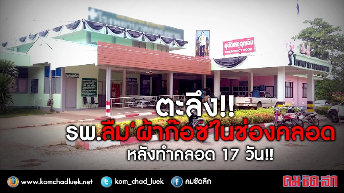 รพ.รับผิดลืมผ้าก๊อซในช่องคลอด