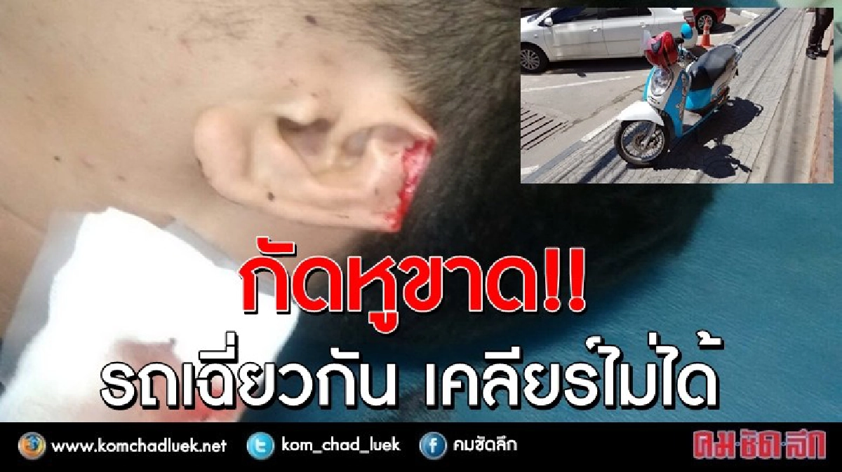 อย่างงี้ก็มี!! รถเฉี่ยวกัน เคลียร์ไม่ได้ "กัดหูขาด"