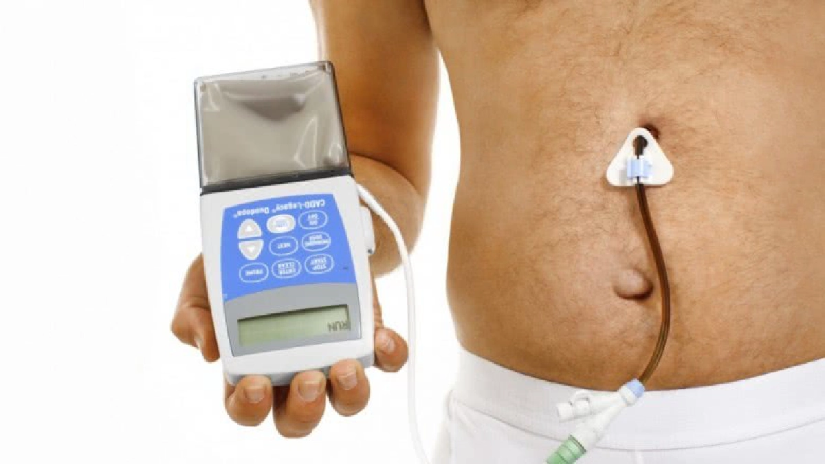 รู้ทันสมองเสื่อม?