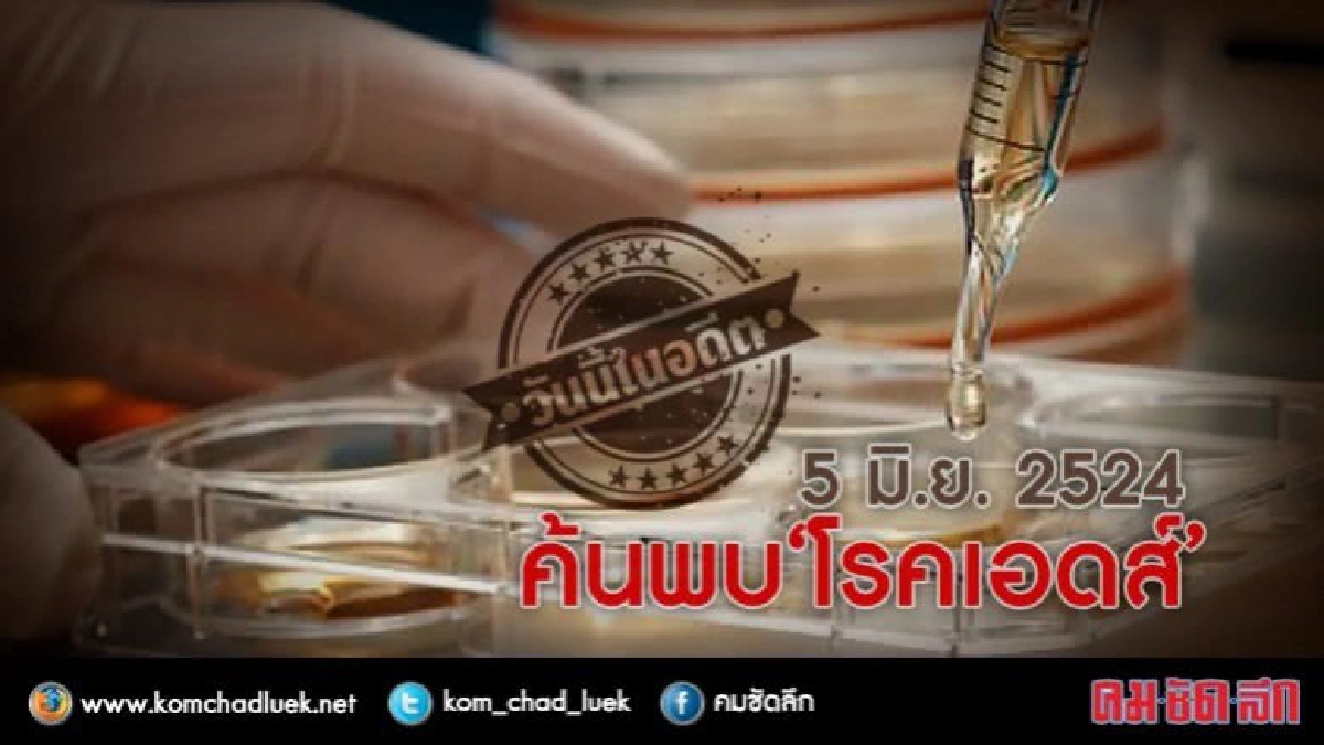 วันนี้ในอดีต  5 มิ.ย. 2524 ค้นพบ‘โรคเอดส์’ครั้งแรก