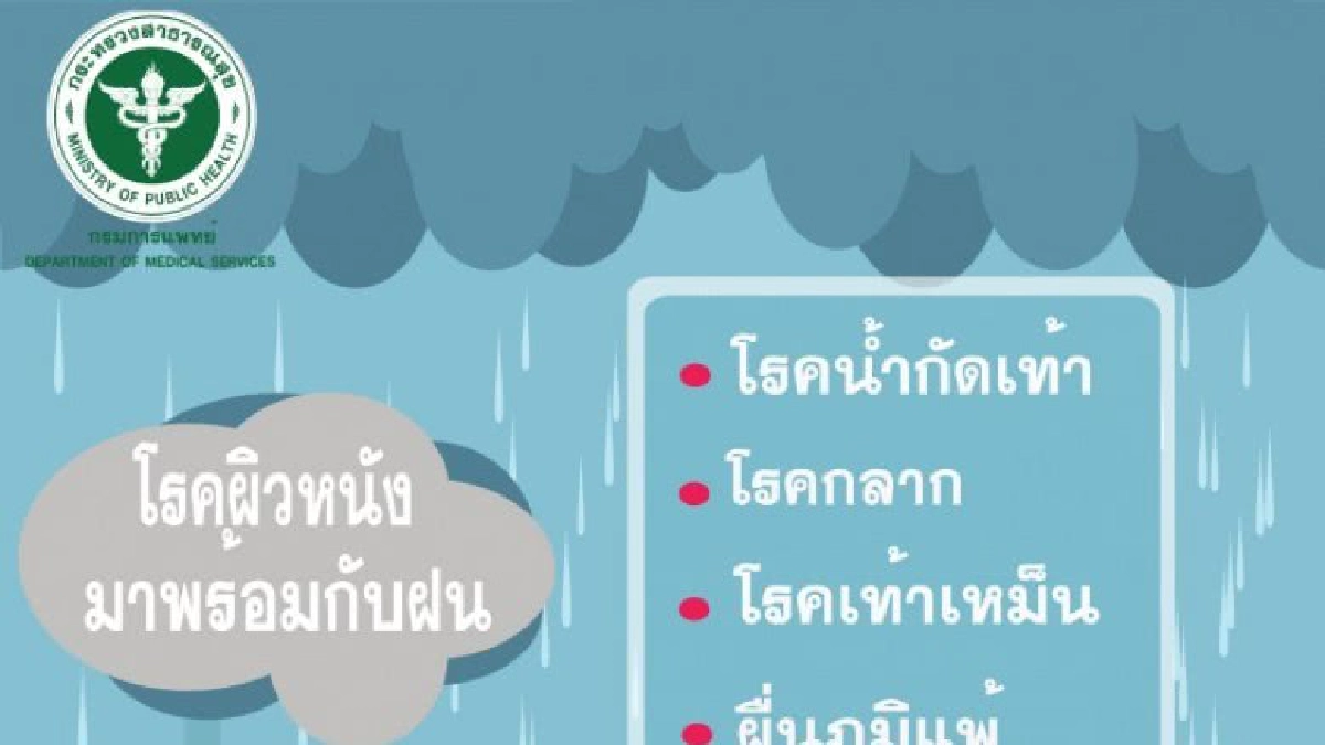 4 โรคผิวหนังต้องระวังในหน้าฝน 4 โรคผิวหนังต้องระวังในหน้าฝน