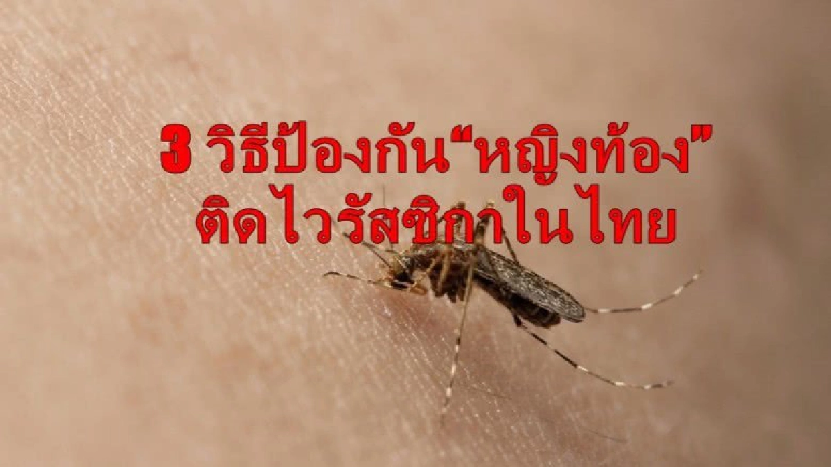 คนไทยมีภูมิคุ้มกัน "ไวรัสซิกา" หรือไม่ คนไทยมีภูมิคุ้มกัน "ไวรัสซิกา" หรือไม่