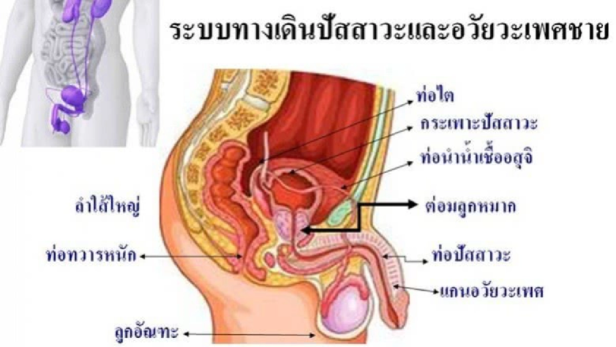  แนะปรับพฤติกรรมเสี่ยงต่อมลูกหมากโต