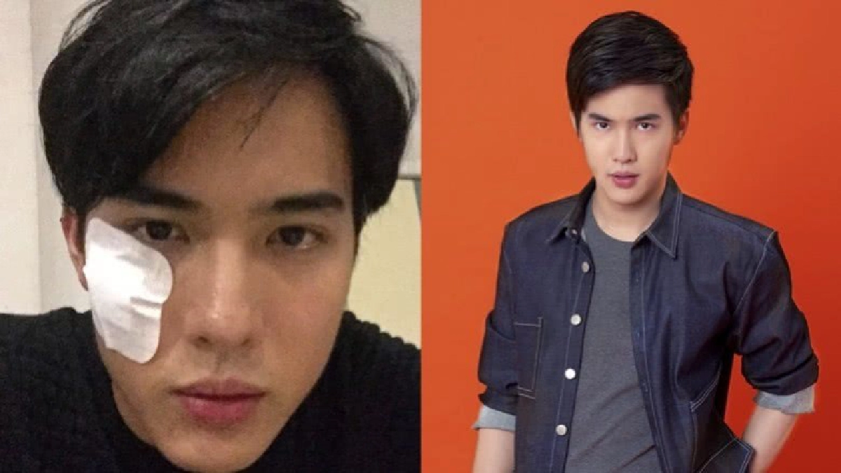 'โก้' วูบกลางเวที หวิดเสียโฉม!! 'โก้' วูบกลางเวที หวิดเสียโฉม!!
