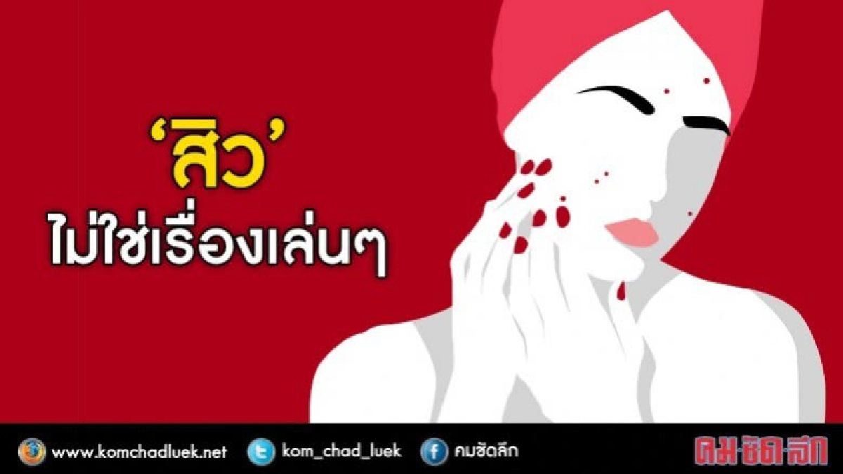 กรมการแพทย์แนะวิธีปฏิบัติเมื่อเป็น"สิว" 