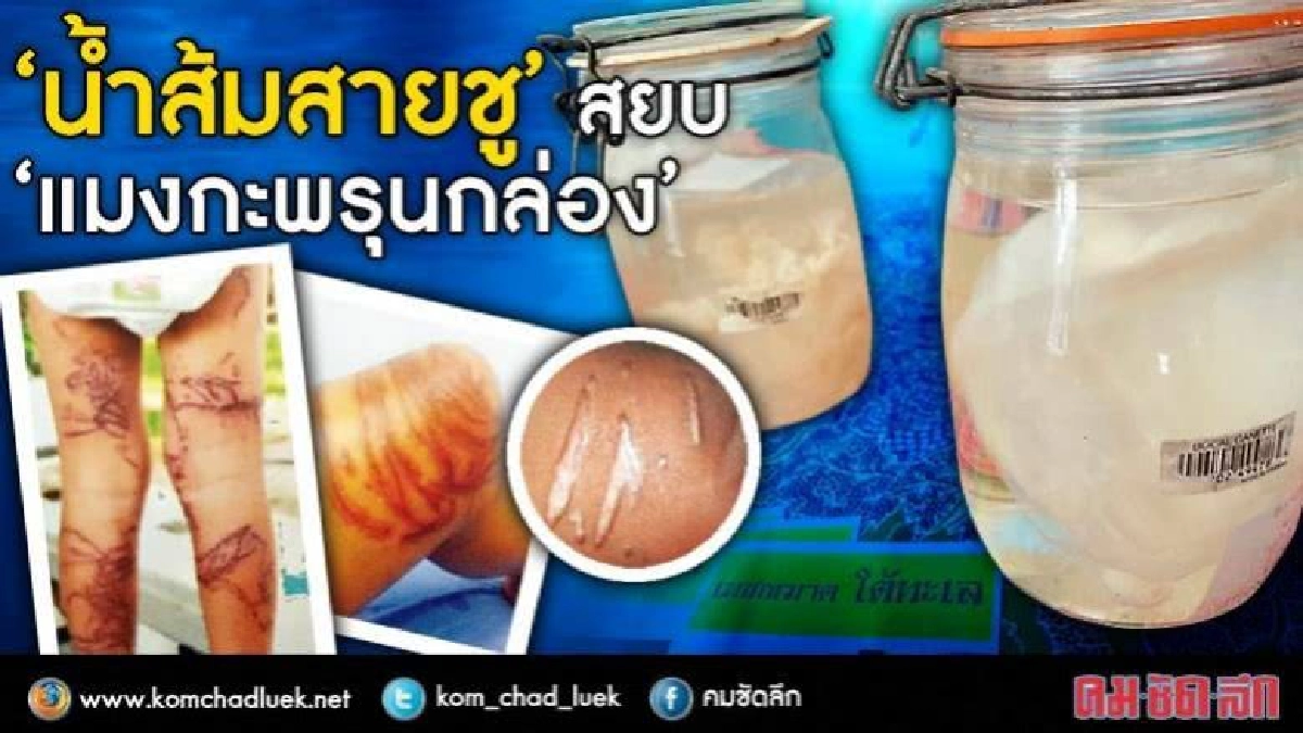 “แมงกะพรุนกล่อง”ที่ว่าร้ายยังต้องพ่าย “น้ำส้มสายชู”