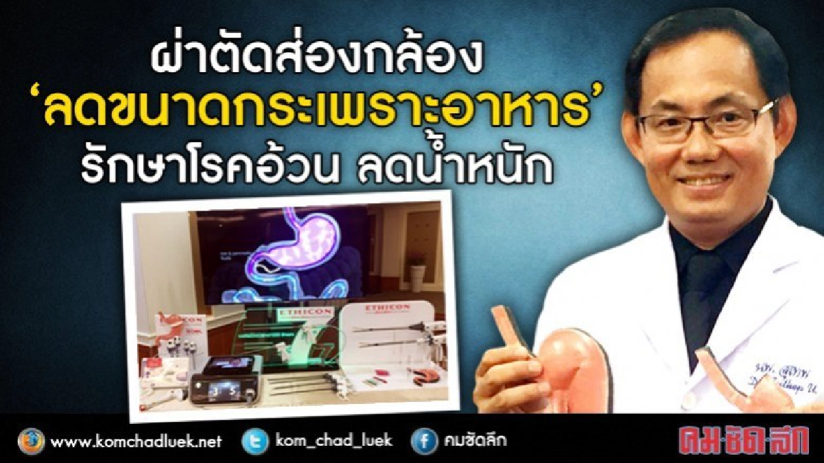 อ้วนอยากผอมผ่าตัดกระเพาะช่วยได้