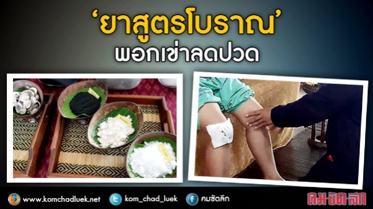 รพร.บ้านดุงใช้"ยาสูตรโบราณ"พอกเข่าลดปวดข้อเข่าเสื่อม รพร.บ้านดุงใช้"ยาสูตรโบราณ"พอกเข่าลดปวดข้อเข่าเสื่อม