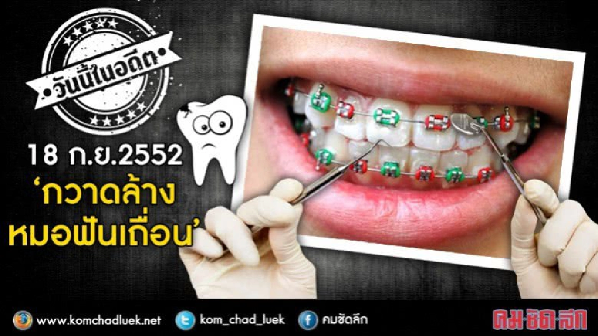 วันนี้ในอดีต18ก.ย.52 กวาดล้าง“หมอฟัน”เถื่อน!! วันนี้ในอดีต18ก.ย.52 กวาดล้าง“หมอฟัน”เถื่อน!!