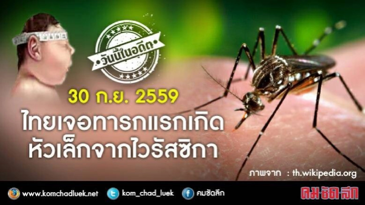 วันนี้ในอดีต 30 ก.ย.59“ไทยเจอทารกแรกเกิดหัวเล็กจากไวรัสซิกา" วันนี้ในอดีต 30 ก.ย.59“ไทยเจอทารกแรกเกิดหัวเล็กจากไวรัสซิกา"