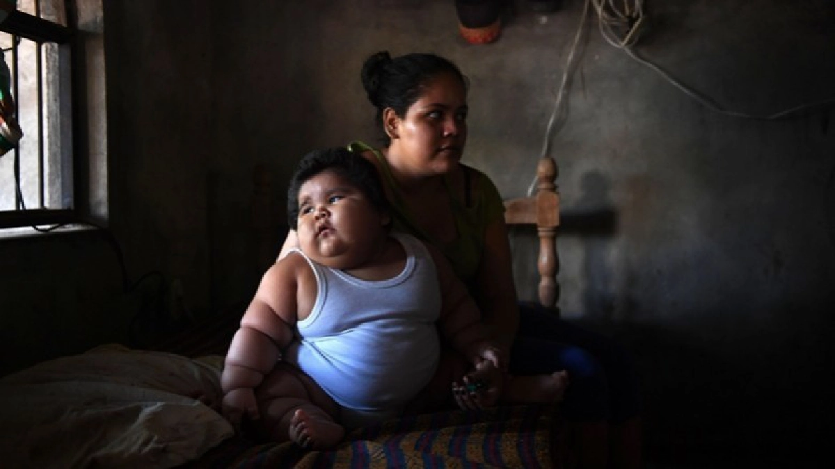 ปริศนาเด็ก 10 เดือนหนัก 28 กิโล