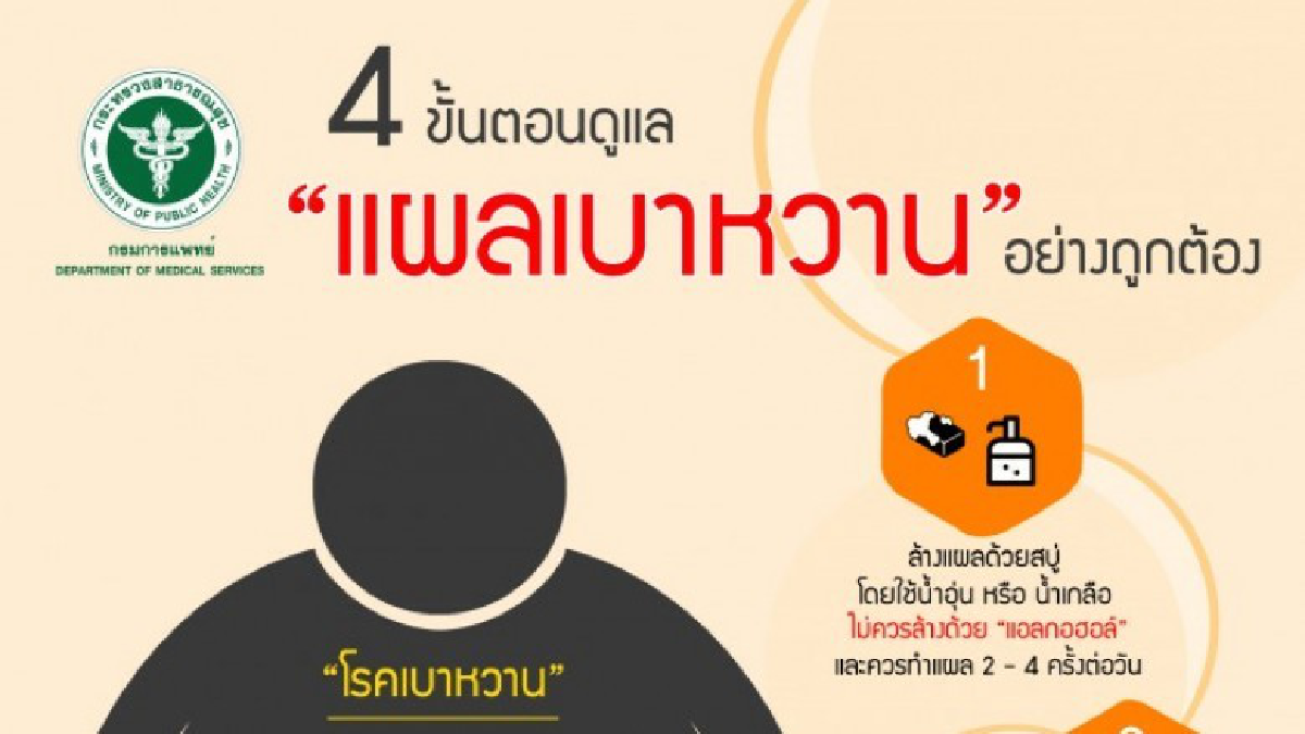 วิธีดูแลแผลเบาหวานลดแทรกซ้อน"แผลติดเชื้อ"