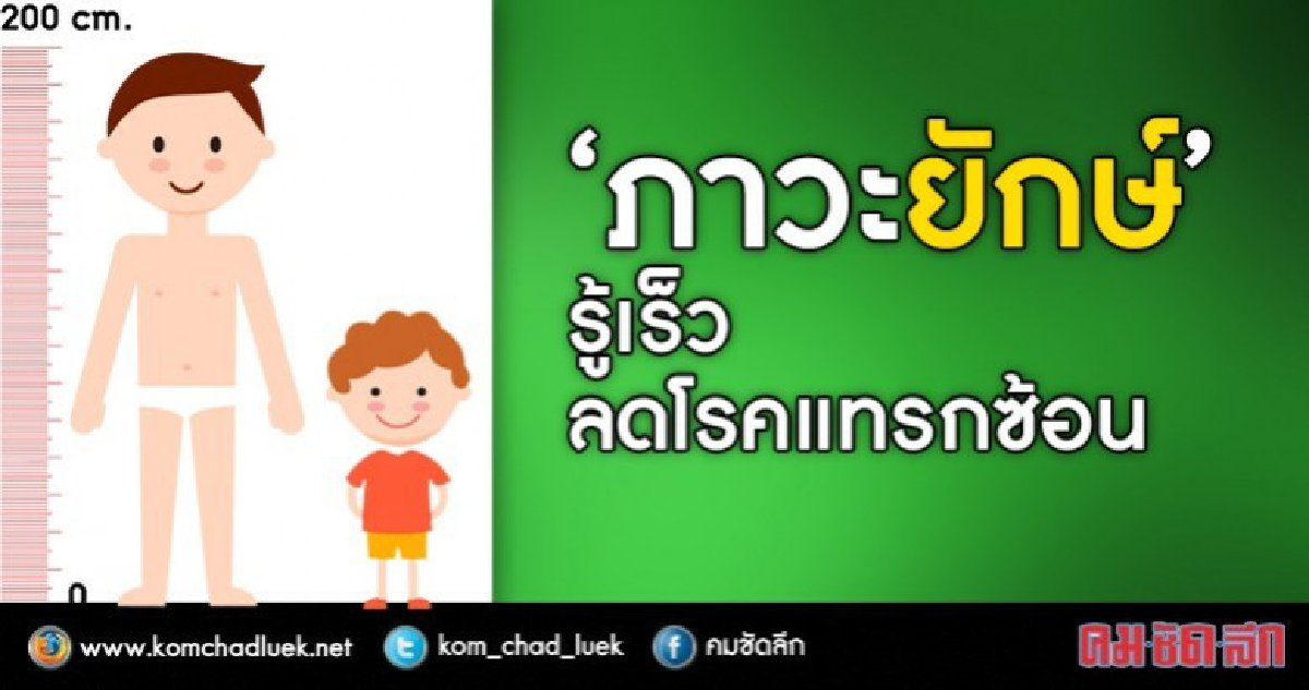 "ภาวะยักษ์" โรคสูงกว่าคนปกติ "ภาวะยักษ์" โรคสูงกว่าคนปกติ