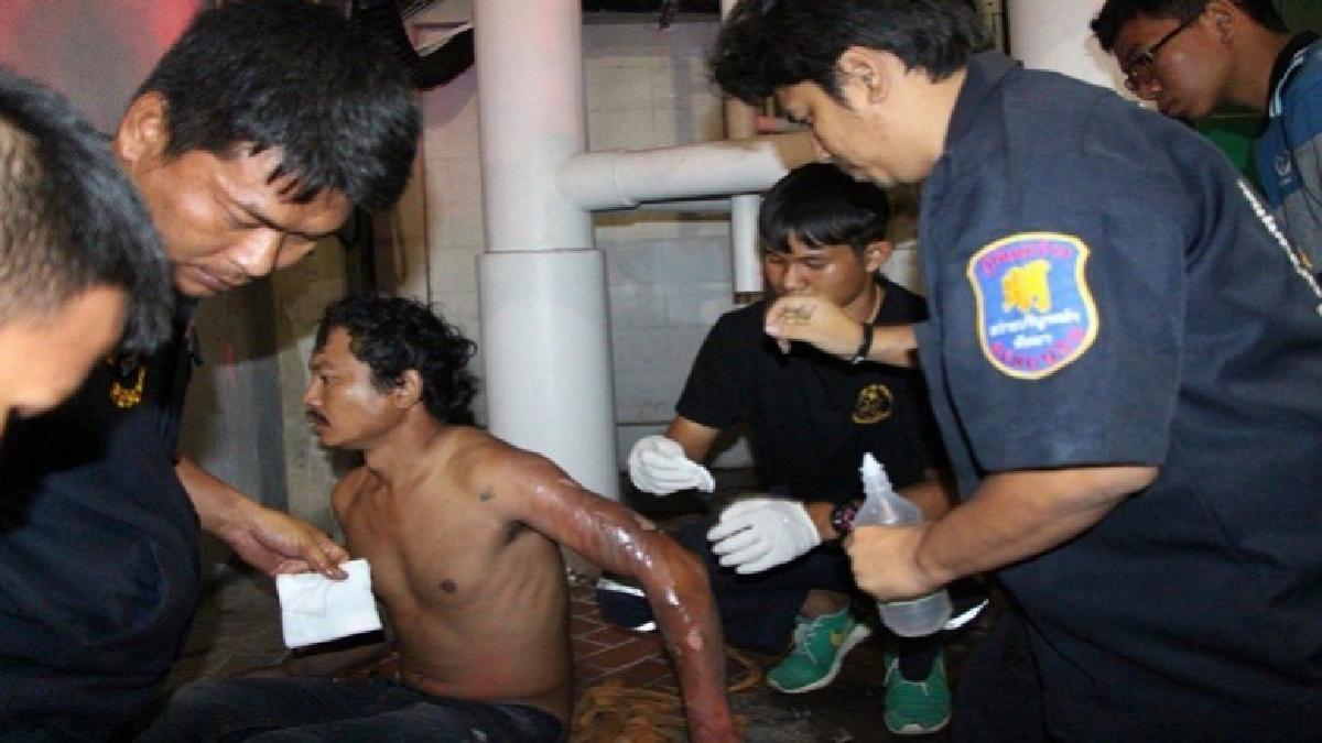 หวิดดับเพราะตลับเมตร ไฟช็อตแขนเกรียม หวิดดับเพราะตลับเมตร ไฟช็อตแขนเกรียม