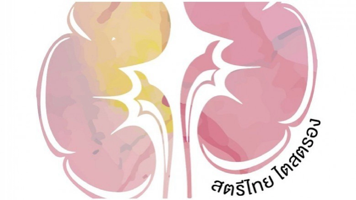 อีก 3 ปีป่วยไตเรื้อรังกว่า 5.9 หมื่นราย 