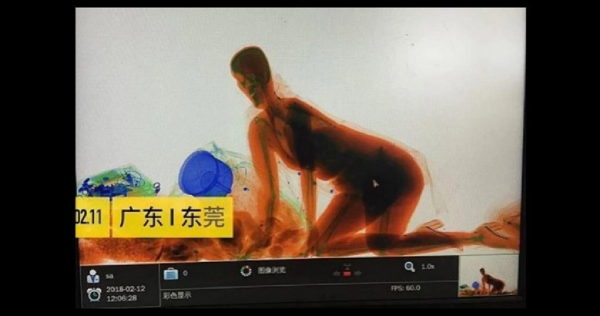 ห่วงกระเป๋าลงทุนคลานผ่านเครื่องเอกซเรย์