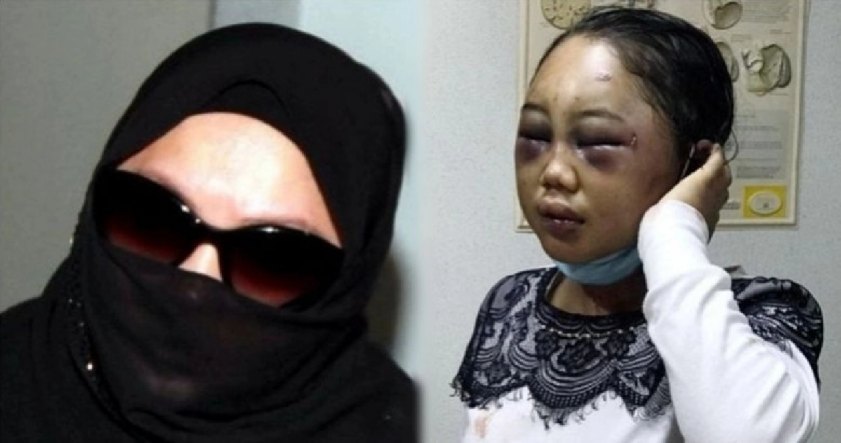 คุก 8 ปีนายจ้างฟาดสาวใช้อินโดนีเซียเจ็บสาหัส คุก 8 ปีนายจ้างฟาดสาวใช้อินโดนีเซียเจ็บสาหัส