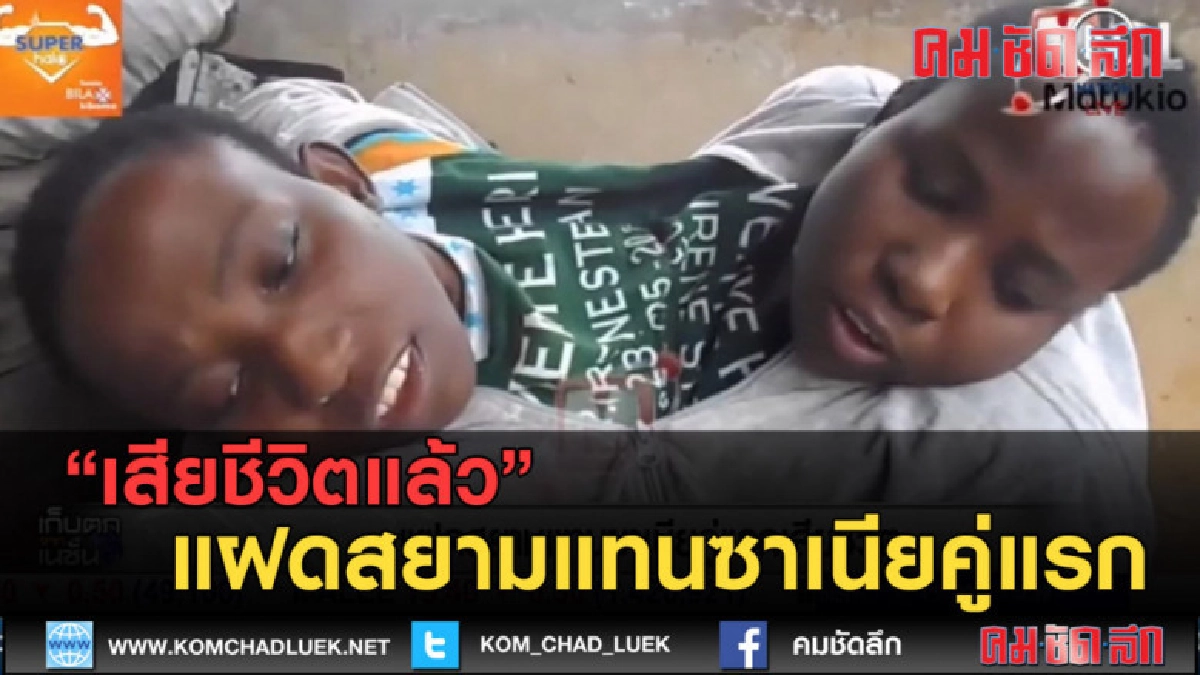 (คลิปข่าว) แฝดสยามนักศึกษาแทนซาเนีย คู่แรกเสียชีวิตแล้ว (คลิปข่าว) แฝดสยามนักศึกษาแทนซาเนีย คู่แรกเสียชีวิตแล้ว