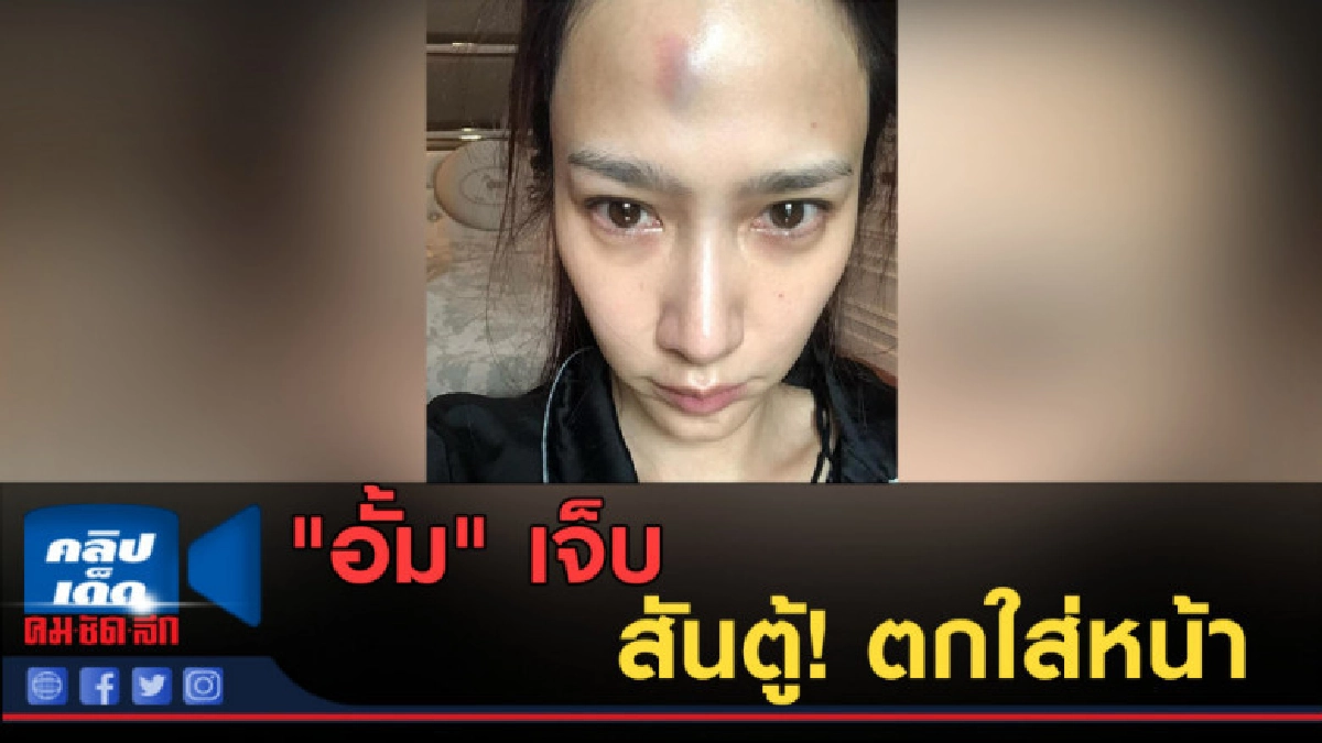 (คลิปข่าว) "อั้ม" เจ็บ สันตู้! ตกใส่หน้า (คลิปข่าว) "อั้ม" เจ็บ สันตู้! ตกใส่หน้า