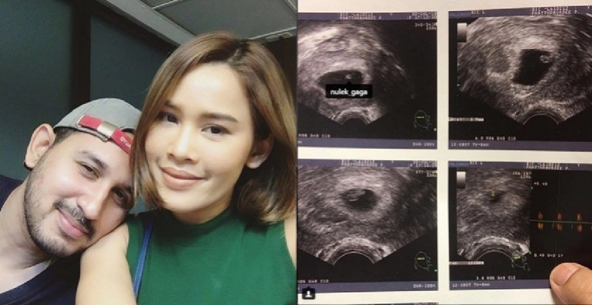 ต้อนรับ "หนูเล็ก ก่อนบ่าย" ในฐานะว่าที่คุณแม่คนใหม่