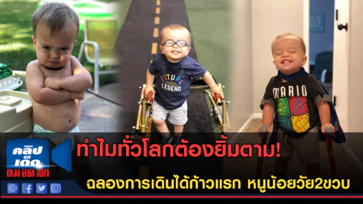 (คลิปข่าว)เดินก้าวแรก หนูน้อยป่วยเป็นโรคกระดูกสันหลังโหว่ (คลิปข่าว)เดินก้าวแรก หนูน้อยป่วยเป็นโรคกระดูกสันหลังโหว่