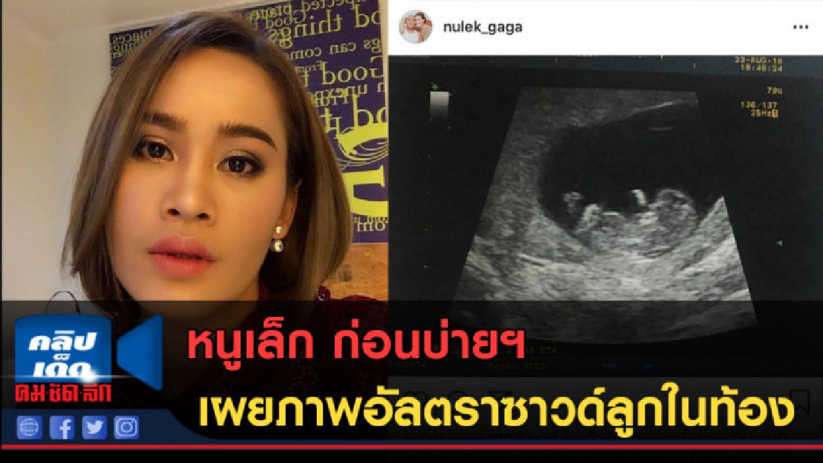 (คลิปข่าว) หนูเล็ก ก่อนบ่ายฯ เผยภาพอัลตราซาวด์ลูกในท้อง (คลิปข่าว) หนูเล็ก ก่อนบ่ายฯ เผยภาพอัลตราซาวด์ลูกในท้อง