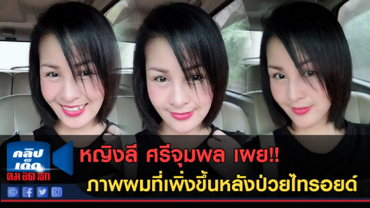 (คลิปข่าว)หญิงลี ศรีจุมพลเผยภาพผมที่เพิ่งขึ้นหลังป่วยไทรอยด์ (คลิปข่าว)หญิงลี ศรีจุมพลเผยภาพผมที่เพิ่งขึ้นหลังป่วยไทรอยด์