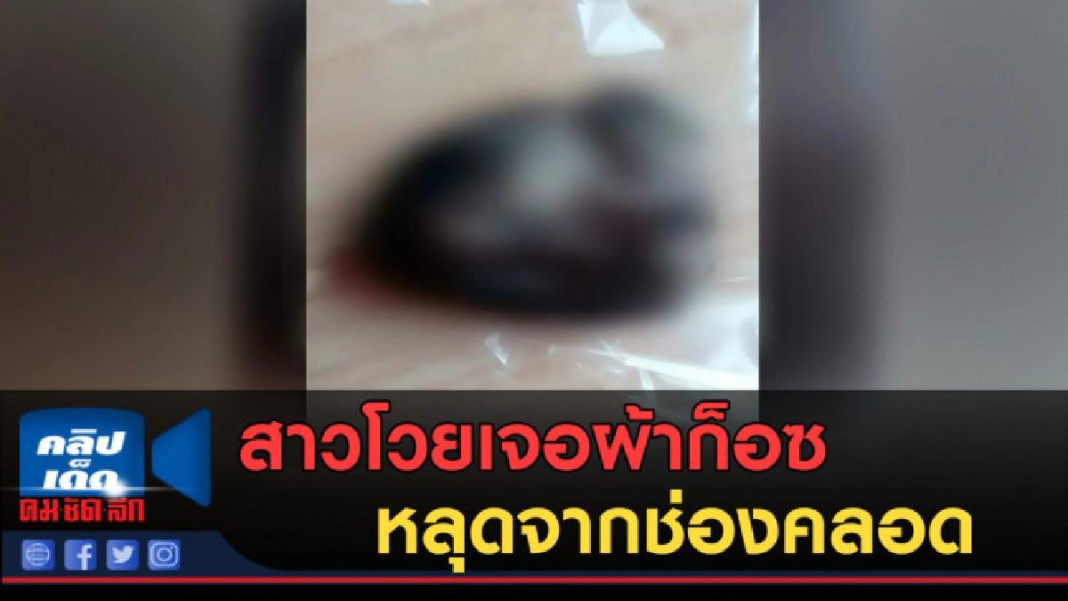 (คลิปข่าว) สาวโวย รพ. เจอผ้าก็อซหลุดมาจากช่องคลอด (คลิปข่าว) สาวโวย รพ. เจอผ้าก็อซหลุดมาจากช่องคลอด