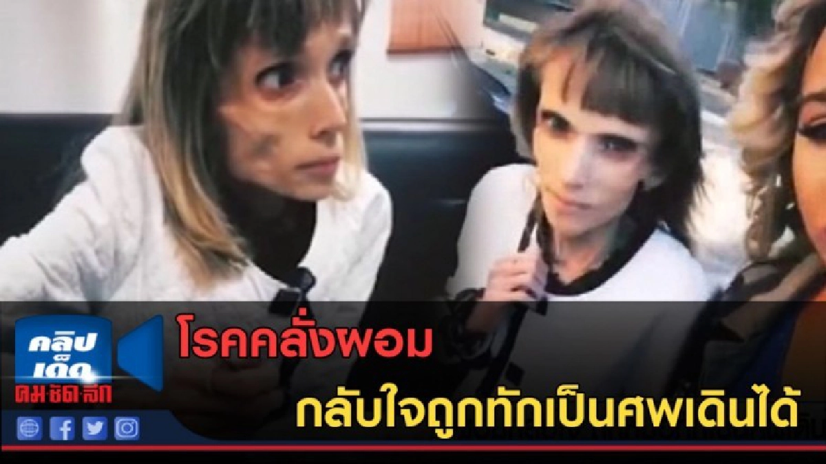 (คลิปข่าว) คลั่งผอม กลับใจถูกทักเป็นศพเดินได้ (คลิปข่าว) คลั่งผอม กลับใจถูกทักเป็นศพเดินได้