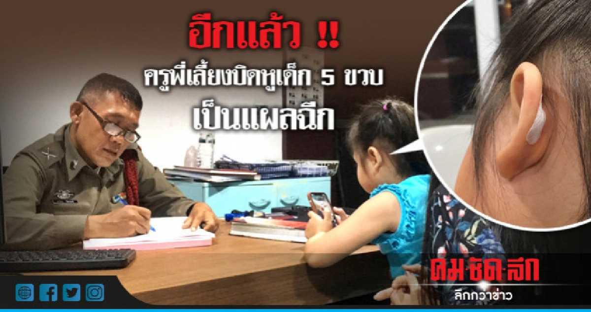 ผู้ปกครองพาลูก 5 ขวบแจ้งความ ครูพี่เลี้ยงบิดหูฉีก !! ผู้ปกครองพาลูก 5 ขวบแจ้งความ ครูพี่เลี้ยงบิดหูฉีก !!