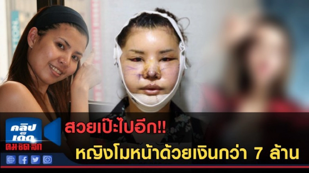 (คลิปข่าว) สาวไทยอัพหน้าใหม่ ศัลยกรรมเสียไป 7 ล้าน (คลิปข่าว) สาวไทยอัพหน้าใหม่ ศัลยกรรมเสียไป 7 ล้าน