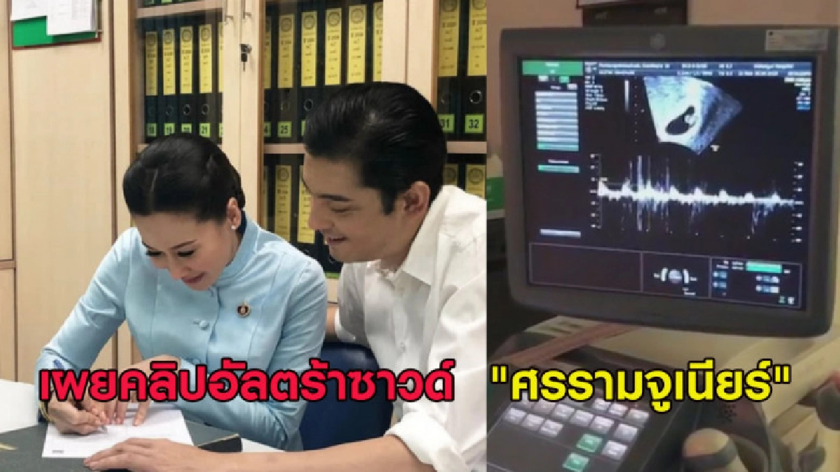 หนุ่ม ศรรามโพสต์คลิปอัลตร้าซาวด์หลังวิวาห์ ติ๊ก บิ๊กบราเธอร์ หนุ่ม ศรรามโพสต์คลิปอัลตร้าซาวด์หลังวิวาห์ ติ๊ก บิ๊กบราเธอร์