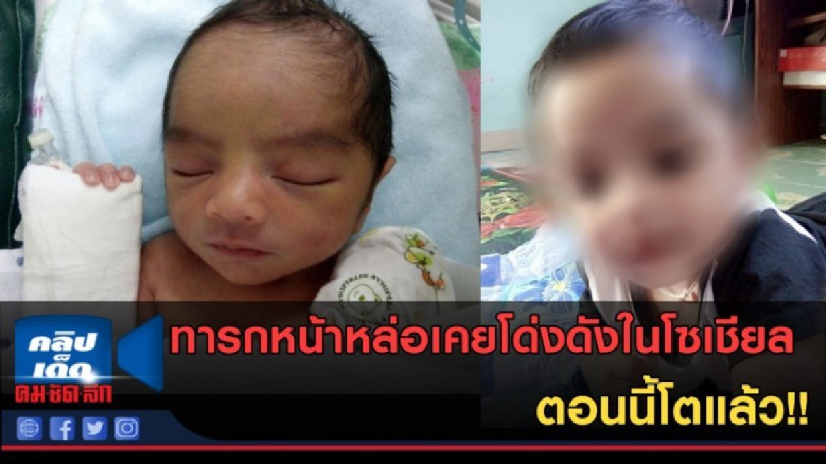 (คลิปข่าว) ทารกหน้าหล่อเคยโด่งดังในโซเชียล ตอนนี้โตแล้ว!! (คลิปข่าว) ทารกหน้าหล่อเคยโด่งดังในโซเชียล ตอนนี้โตแล้ว!!