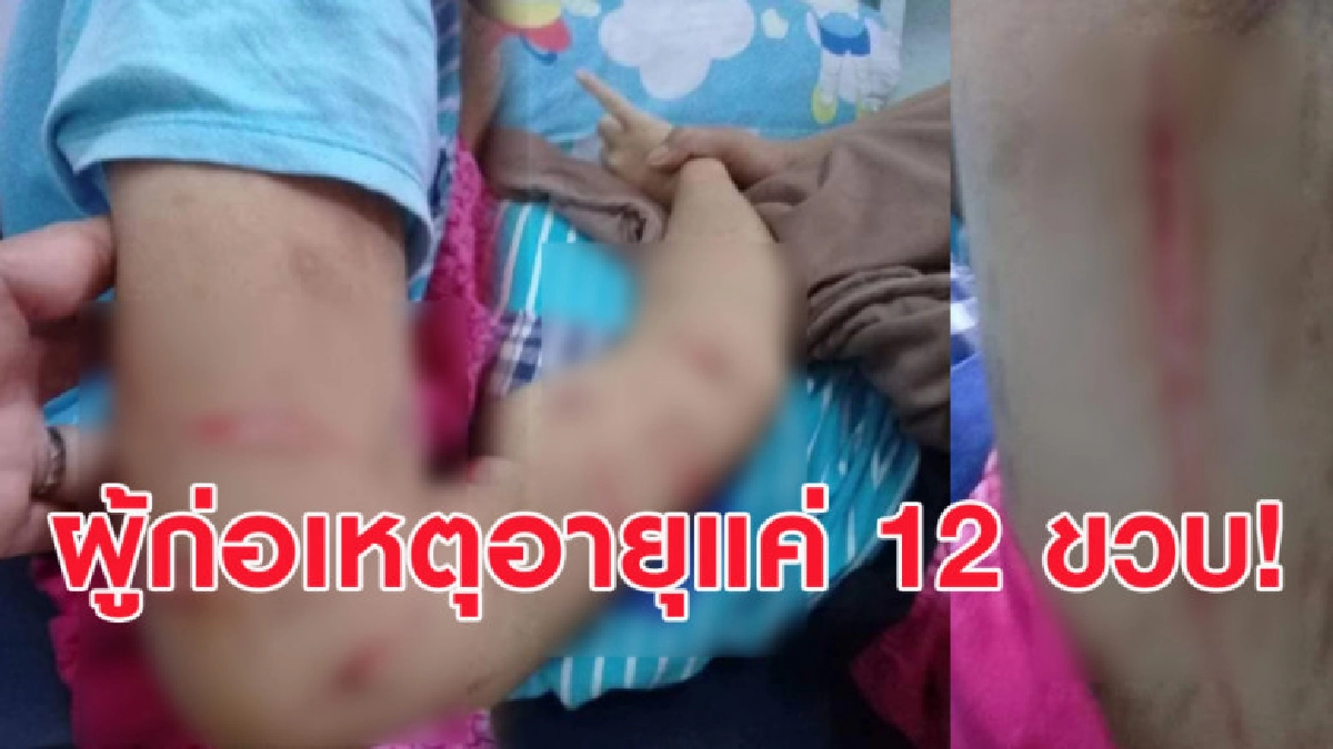 เปิดภาพสะเทือนใจ! หญิงตาบอดเป็นใบ้ ถูกเด็กอายุ 12 กรีดแขน ขา เปิดภาพสะเทือนใจ! หญิงตาบอดเป็นใบ้ ถูกเด็กอายุ 12 กรีดแขน ขา