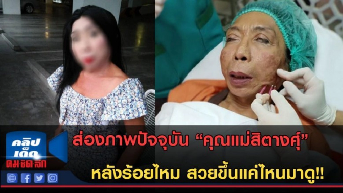 (คลิปข่าว)ส่องภาพปัจจุบัน 'คุณแม่สิตางศุ์' หลังร้อยไหม (คลิปข่าว)ส่องภาพปัจจุบัน 'คุณแม่สิตางศุ์' หลังร้อยไหม