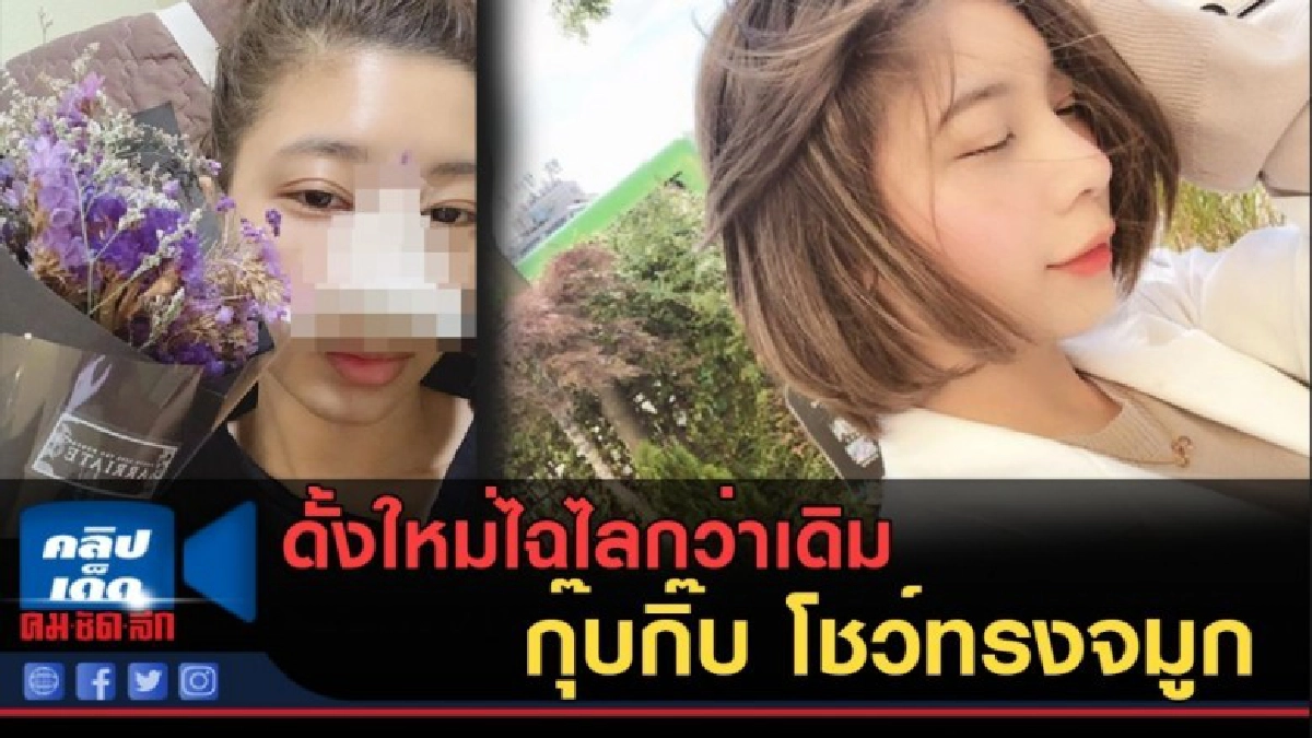 ดั้งใหม่ไฉไลกว่าเดิม กุ๊บกิ๊บ โชว์ทรงจมูกหลังงัดไกลถึงเกาหลี ดั้งใหม่ไฉไลกว่าเดิม กุ๊บกิ๊บ โชว์ทรงจมูกหลังงัดไกลถึงเกาหลี