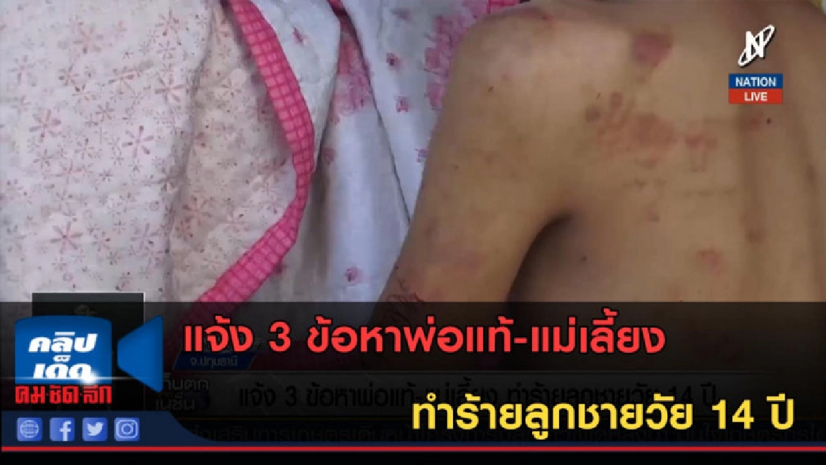 (คลิปข่าว) แจ้ง 3 ข้อหาพ่อแท้-แม่เลี้ยง ทำร้ายลูกชายวัย 14 (คลิปข่าว) แจ้ง 3 ข้อหาพ่อแท้-แม่เลี้ยง ทำร้ายลูกชายวัย 14