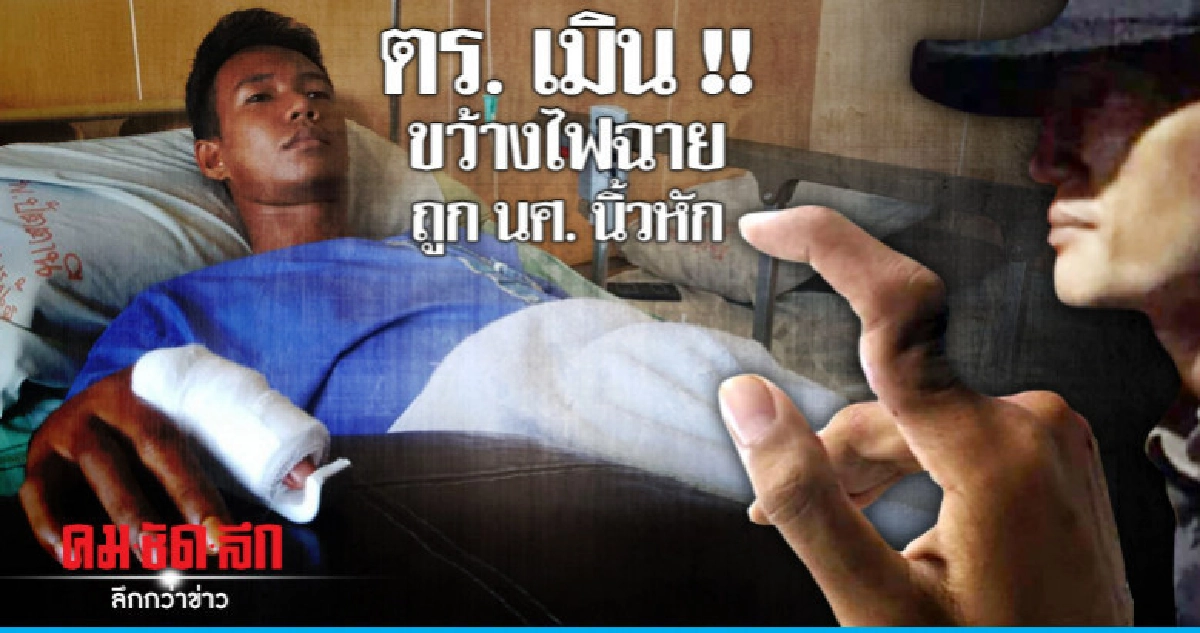 โวย ตร. ขว้างไฟฉายถูกนิ้วหัก โวย ตร. ขว้างไฟฉายถูกนิ้วหัก