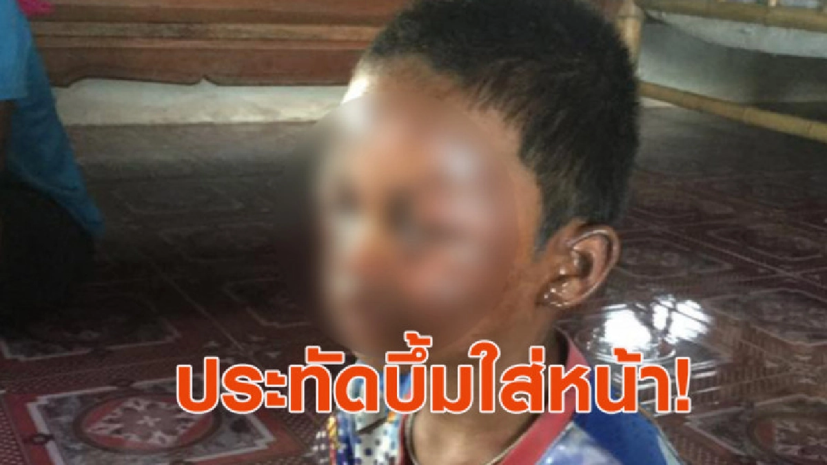 เด็กเก็บประทัดมาเล่น บึ้มใส่หน้าแผลเหวอะ เด็กเก็บประทัดมาเล่น บึ้มใส่หน้าแผลเหวอะ