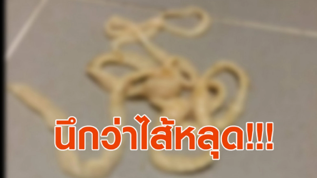 นึกว่าไส้หลุด! หนุ่มโพสต์เล่าเหตุการณ์ระหว่างขับถ่าย นึกว่าไส้หลุด! หนุ่มโพสต์เล่าเหตุการณ์ระหว่างขับถ่าย