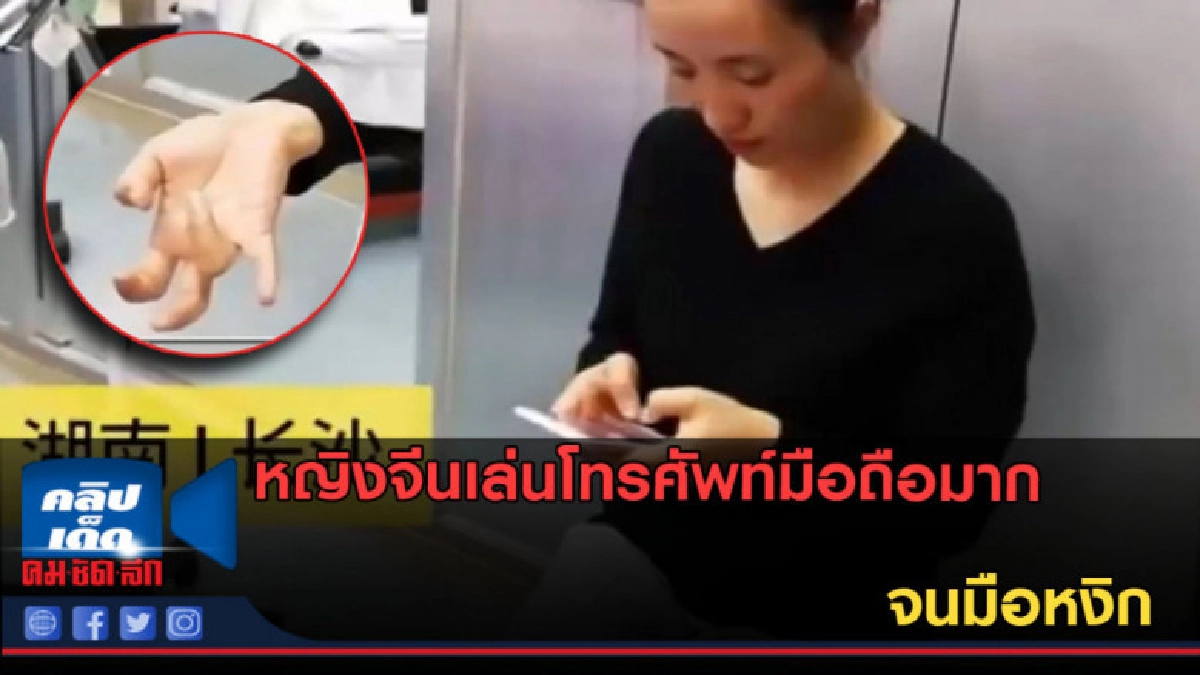 (คลิปข่าว) หญิงจีนเล่นโทรศัพท์มือถือมาก จนมือหงิก (คลิปข่าว) หญิงจีนเล่นโทรศัพท์มือถือมาก จนมือหงิก