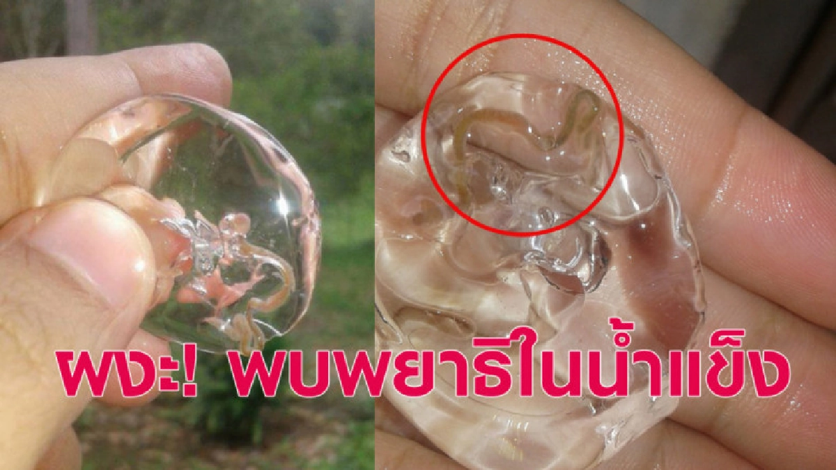 เห็นแล้วต้องผงะ! พบพยาธิในน้ำแข็ง เห็นแล้วต้องผงะ! พบพยาธิในน้ำแข็ง