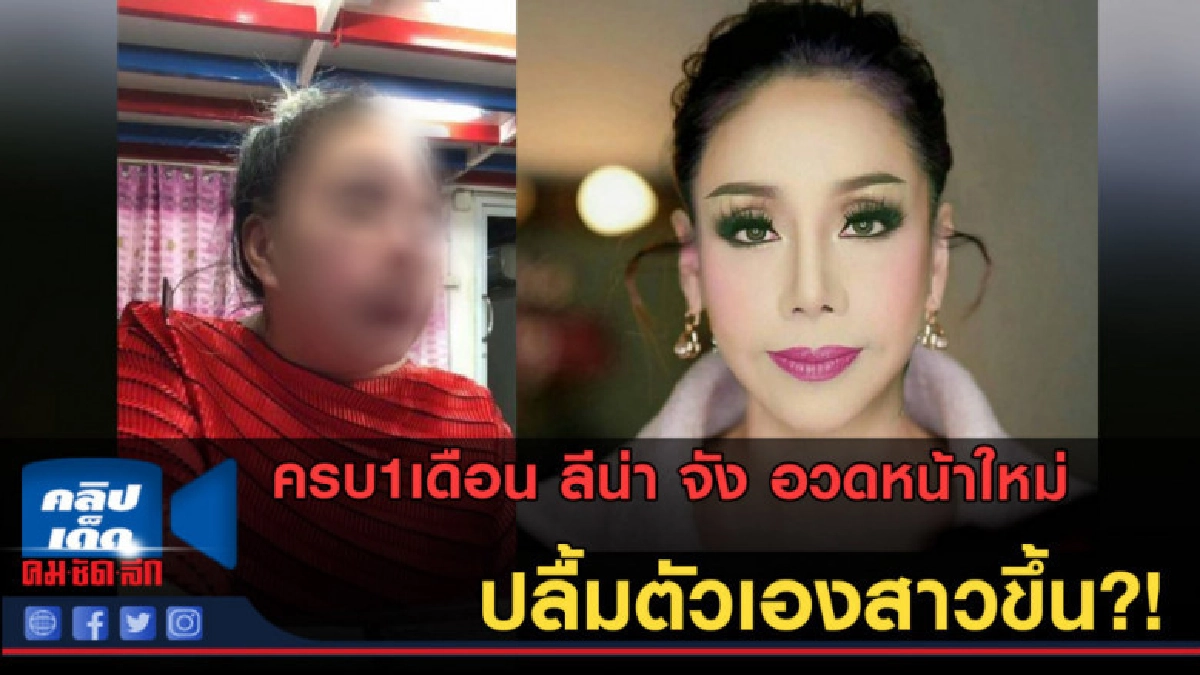 (คลิปข่าว) ลีน่า จัง อวดหน้าใหม่ หลังครบ1เดือนที่ดูดไขมัน (คลิปข่าว) ลีน่า จัง อวดหน้าใหม่ หลังครบ1เดือนที่ดูดไขมัน