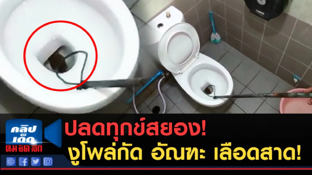 (คลิปข่าว) ปลดทุกข์สยอง! งูโพล่กัด อัณฑะ เลือดสาด! (คลิปข่าว) ปลดทุกข์สยอง! งูโพล่กัด อัณฑะ เลือดสาด!