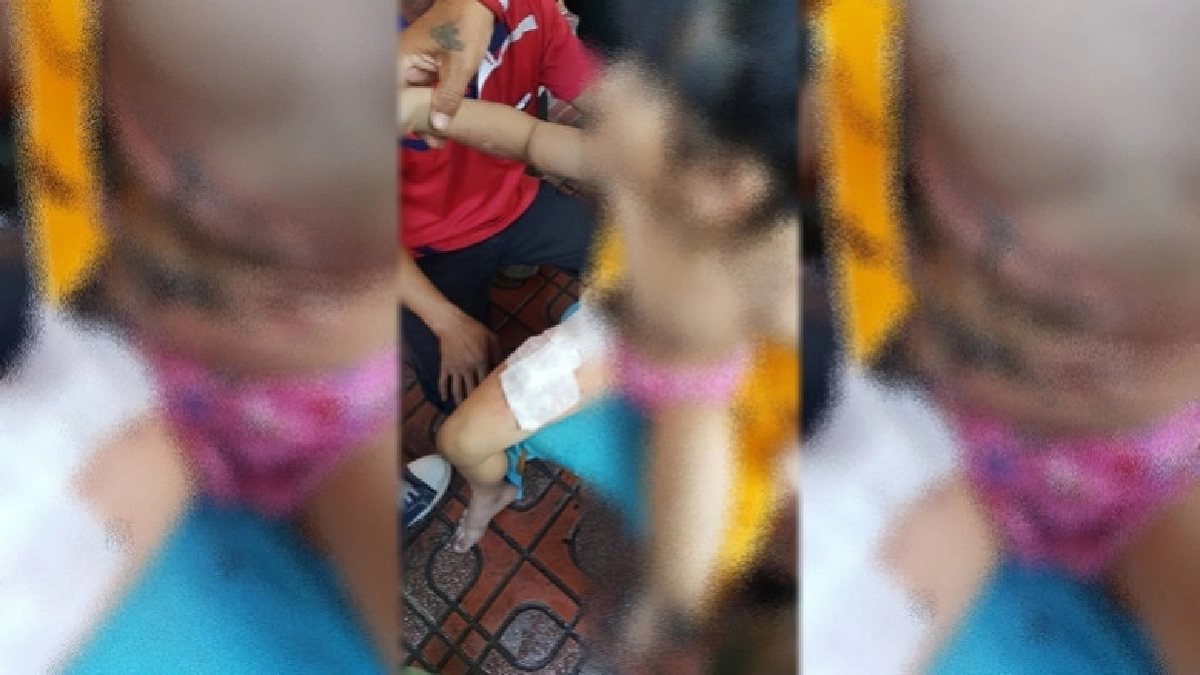 ลูกโป่งอัดแก๊สกระทบไฟ ลูกโป่งอัดแก๊สกระทบไฟ