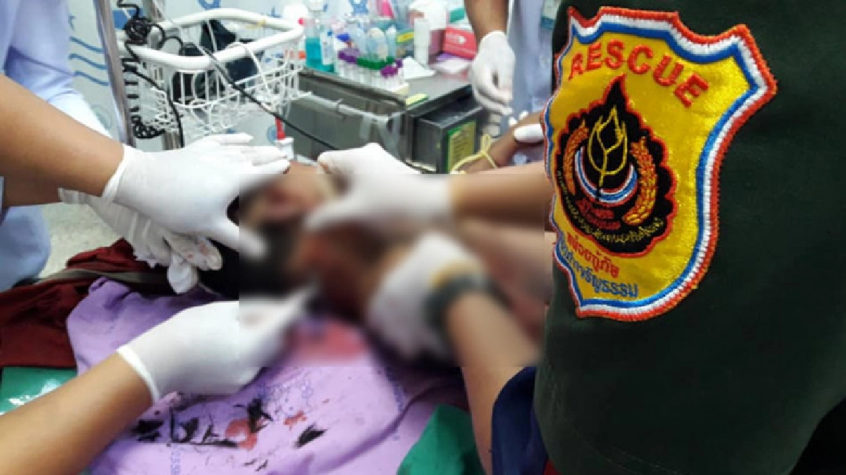 สลด ฝูงสุนัขจรจัดรุมกัด ด.ช. 7 ขวบ อาการสาหัส แผลนับร้อย สลด ฝูงสุนัขจรจัดรุมกัด ด.ช. 7 ขวบ อาการสาหัส แผลนับร้อย